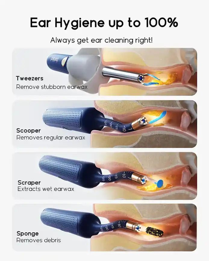 Bebird Earsight Plus I35R Ear Wax Removal Camera Kit | HD Wireless Flexible Otoscope & Pain - Free Tweezer - DorfaX